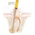 Imagine pentru categorie Endodontie
