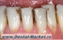 Imaginea Profijet Airflow dentar