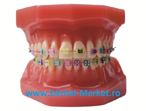 Imaginea Model dinti ortodontie